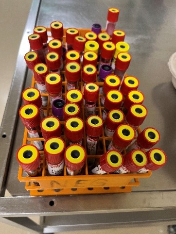 Blutröhrchen lange Nacht der Urologie 2025