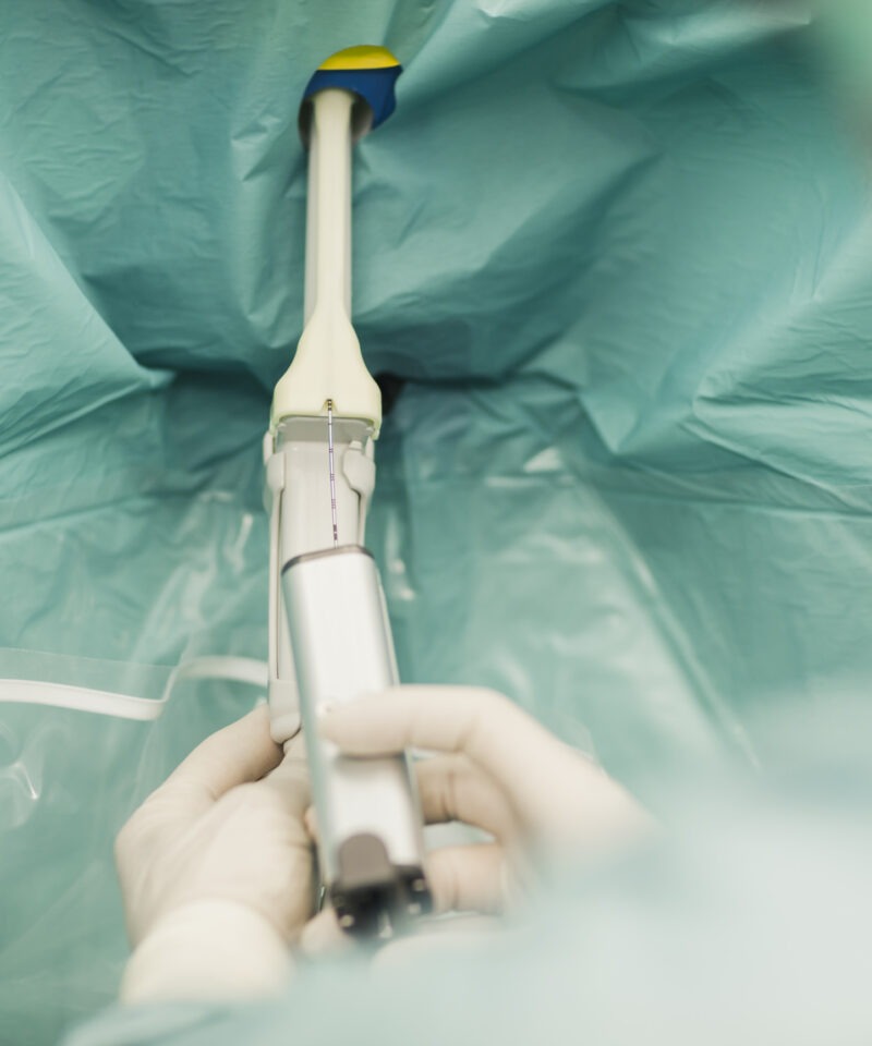 der Urologe macht eine minimal invasive OP