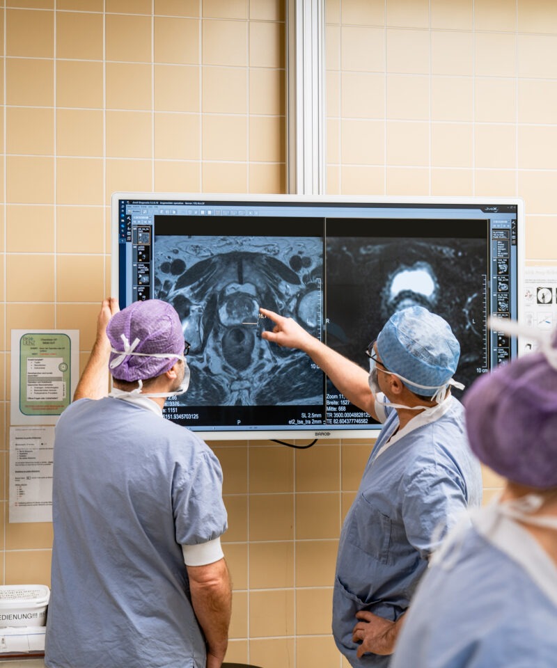 Die Urologen sichten das Untersuchungsbild vor der OP