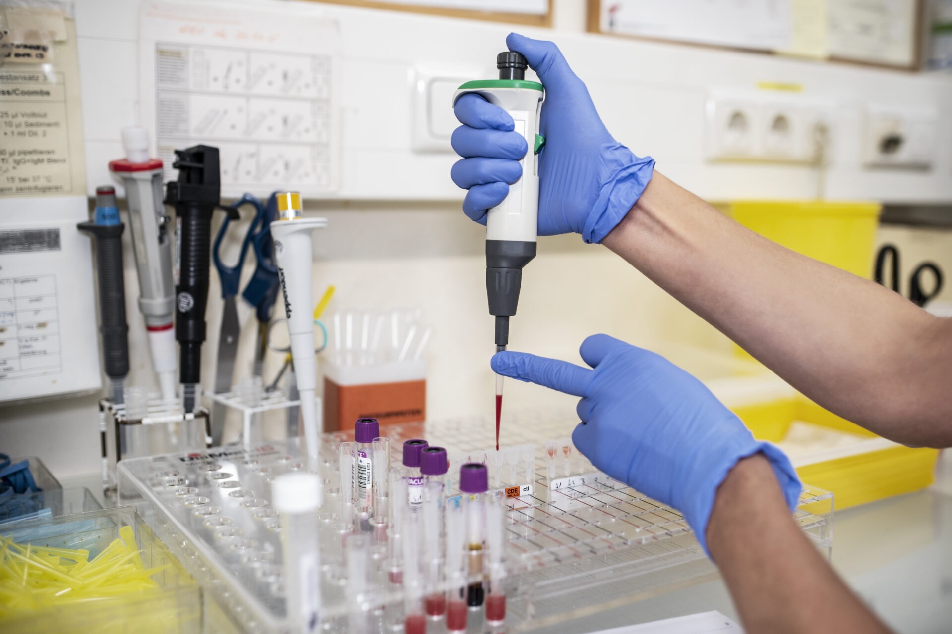 Analyse der Blutproben