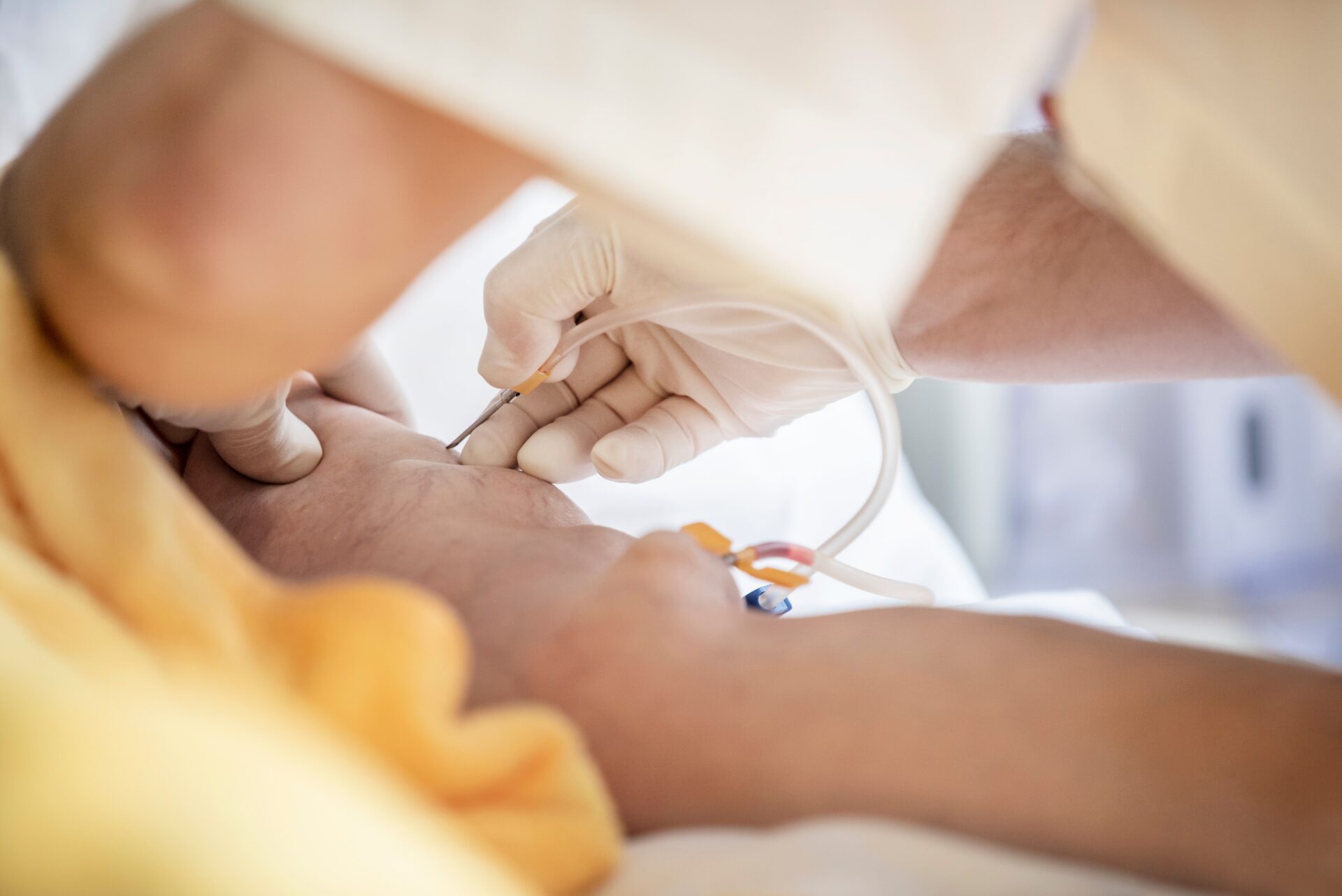 die diplomierte Pflegekraft legt einer Kanüle zur Blutwäsche am Patienten