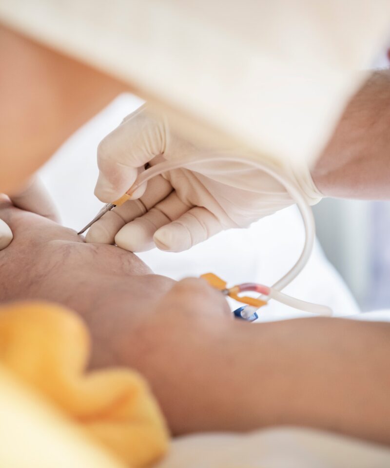 die diplomierte Pflegekraft legt einer Kanüle zur Blutwäsche am Patienten