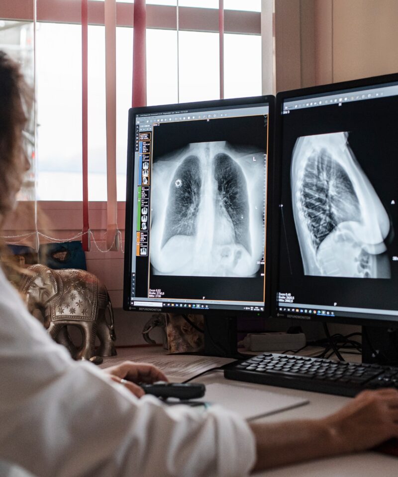 die Radiologin während der Befundung der Mammographie
