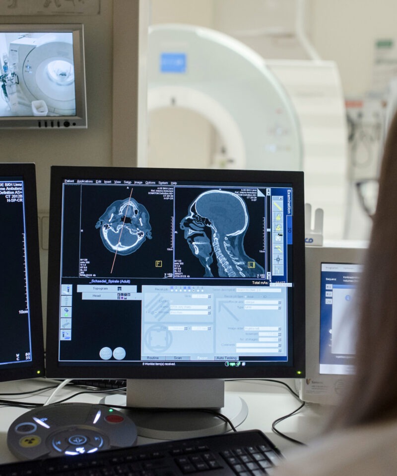 das Bild zeigt einen Befundungsbildschirm mit Computertomographischen Bilder der Kopf-/Halsregion
